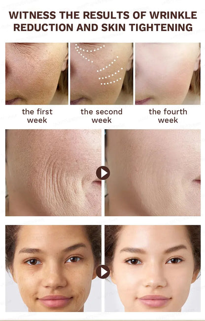 No wrinkles, 20 years younger