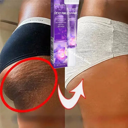 Nicotinamide Brightening Cream For Dark Skin Effective Lighten Thigh Inner Bleach Remove Melanin Private Parts Brighten Cream
