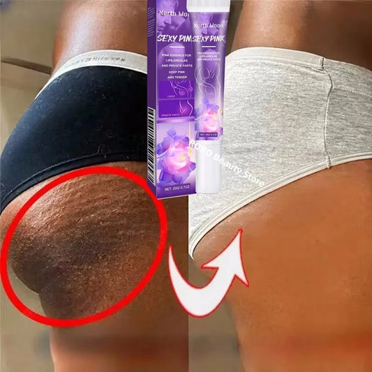 Nicotinamide Brightening Cream For Dark Skin Effective Lighten Thigh Inner Bleach Remove Melanin Private Parts Brighten Cream