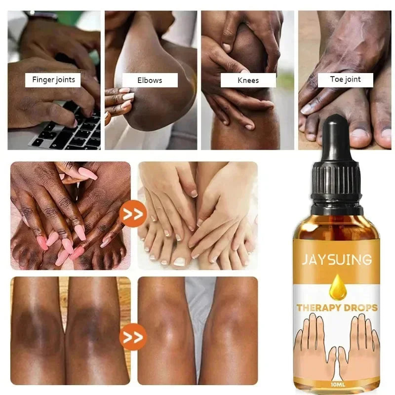 Dark Knuckles Fast Brighten Serum Elbows Hands Knee Armpits Brightening Serum Clarify Black Skin Lighten Stains Remover Essence