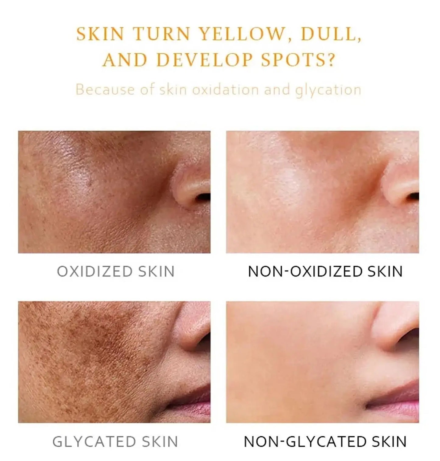 Whitening Freckle Cream Melasma Dark Spots Pigmentation Removal Product Fade Stain Melanin Fast Repair Brighten Korean Skin Care