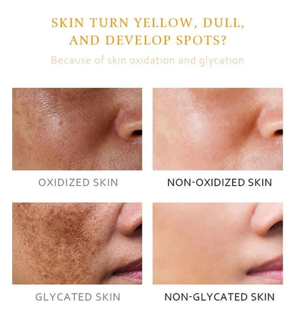 Whitening Freckle Cream Melasma Dark Spots Pigmentation Removal Product Fade Stain Melanin Fast Repair Brighten Korean Skin Care