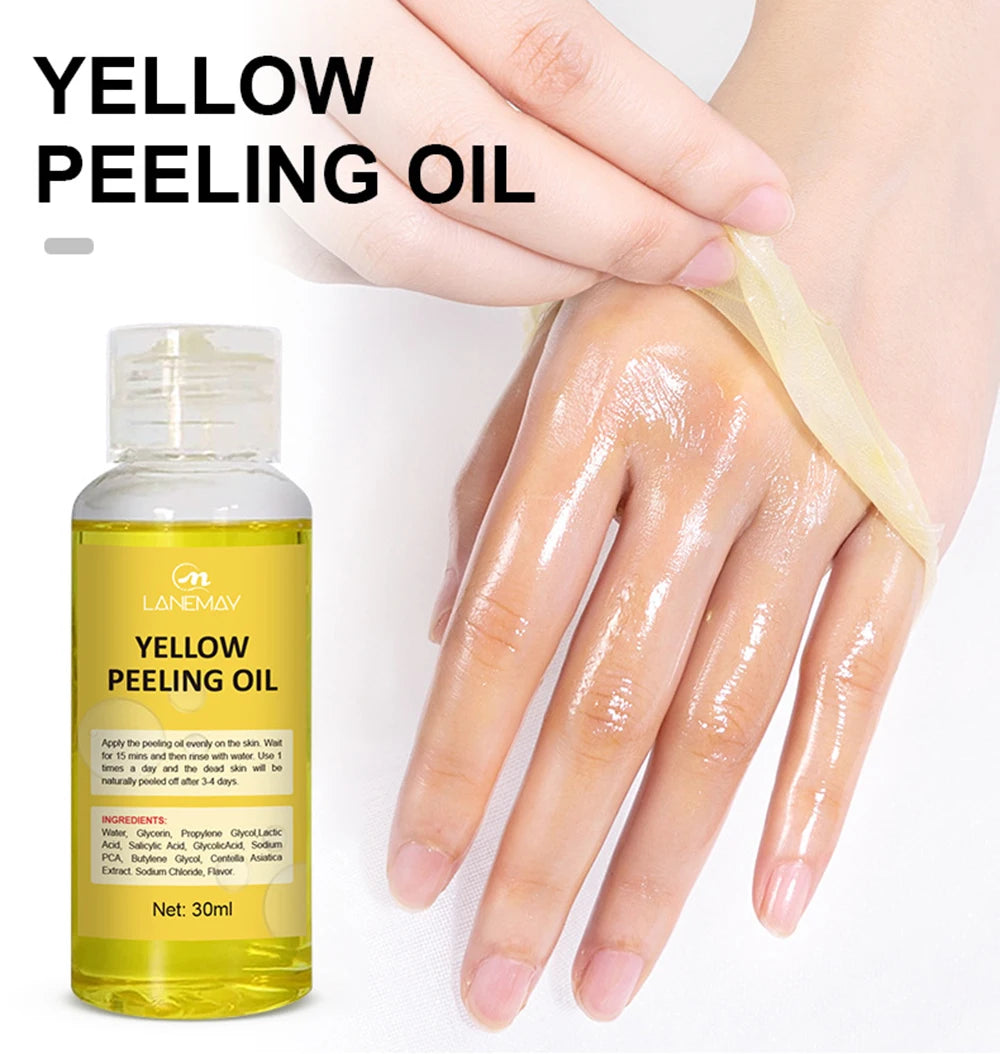 Strong Yellow Peeling Oil Bleach Dark Skin Whiten Lotion Lighten Body Elbow Knee Hand Exfoliate Dead Skin Nourish Even Skin Tone