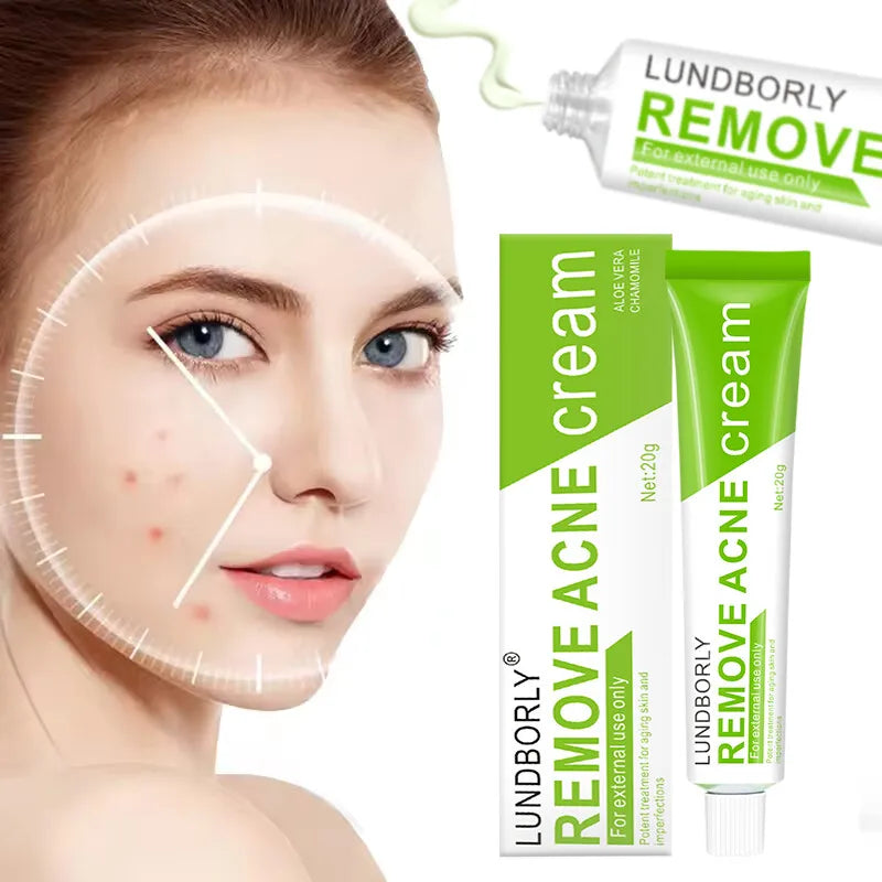 Natural Herbal Face Cream 20g Acne Cream with Salicylic Acid Oil Control Moisturizing Fading Acne Marks Gentle Non Irritating 20g CHINA 20g