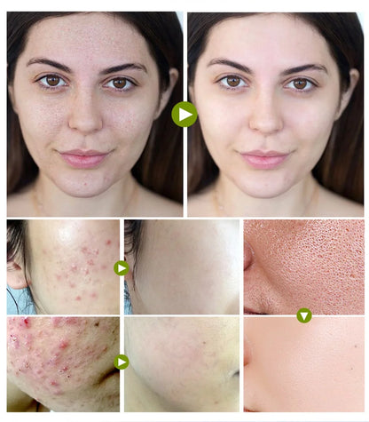 Salicylic Acid Pore Shrinking Cream Reduce Large Pore Tighten Refining Face Repair Rough Dull Pore Brighten Moisturize Skin Care