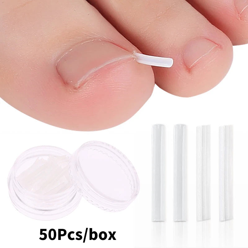 50Pcs Ingrown Toenail Correction Tool Ingrown Toe Nail Treatment Elastic Patch Sticker Straightening Clip Brace Pedicure Tool Default Title