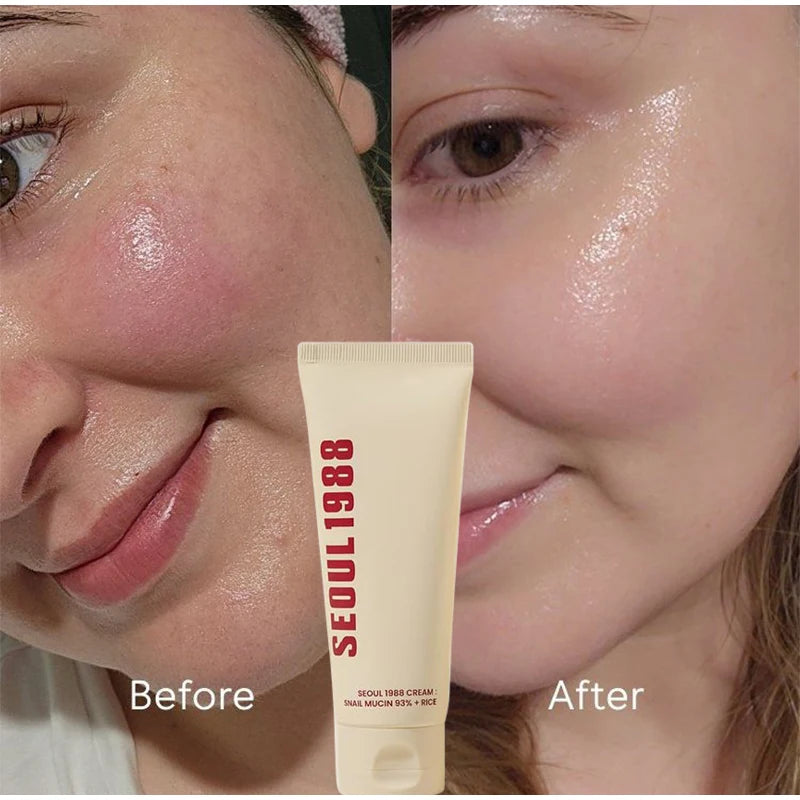 Seoul 1988 100ml Retinal Serum Brand Ginseng Eye Cream Closed Comedones Brighten Face Sunscreen Moisturize Korean Care Essence