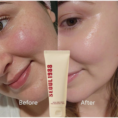 Seoul 1988 100ml Retinal Serum Brand Ginseng Eye Cream Closed Comedones Brighten Face Sunscreen Moisturize Korean Care Essence