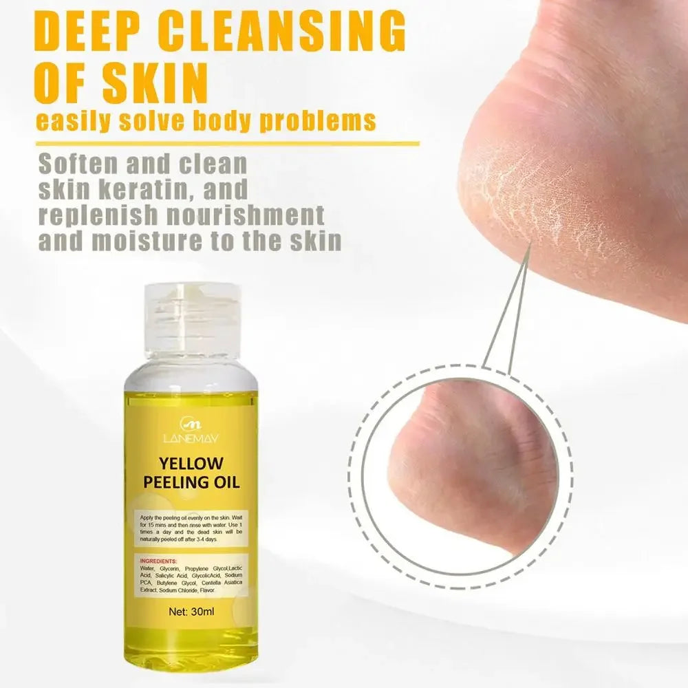 Body Care Exfoliating Yellow Peeling Oil 100% Organic Bleaching Dark Skin Serum Dark Knuckles Fast Whitening Cosmetics