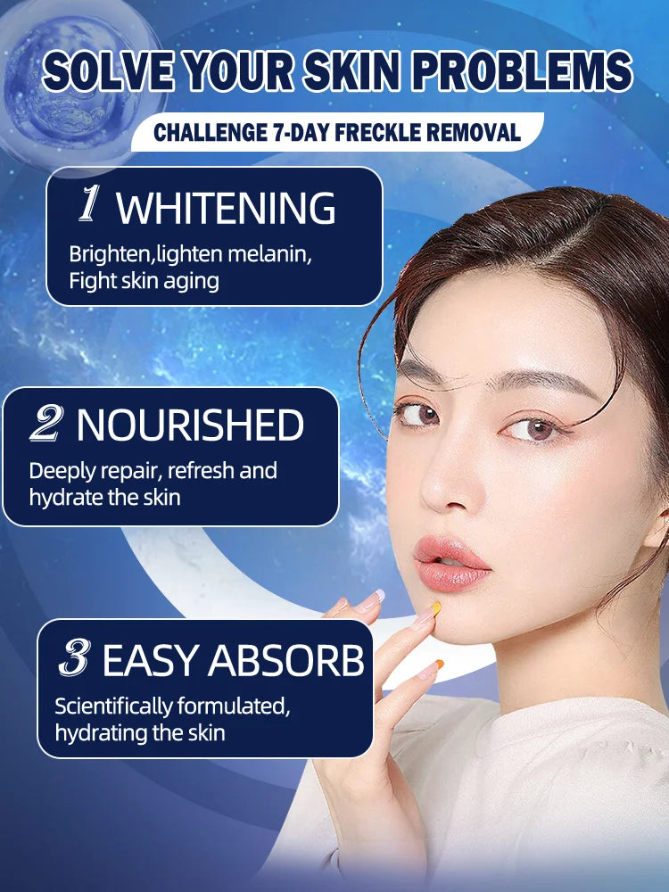 Freckles Cream Dark Spot