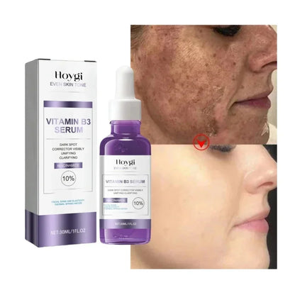 Dark Spots Remover Whitening Serum Face Freckle Melanin Correcting Anti Pigmentation Brighten Beauty Korean Day Night Skin Care 1PC