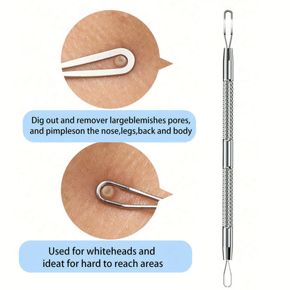 Extra Fine Cellular Acne Blackhead Tweezers - Facial Beauty Remove Acne Needle Tools for Skin Care,Blemish and Whitehead Removal