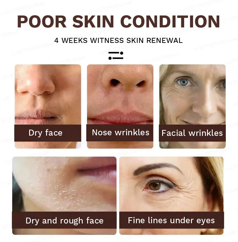 No wrinkles, 20 years younger