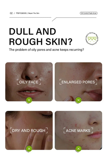 Salicylic Acid Pore Shrinking Cream Eliminate Large Pores Serum Remove Blackhead Acne Repairing Tightening Skin Care Cosmetics
