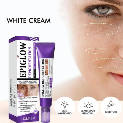 Whitening Freckle Cream Melasma Dark Spots Pigmentation Removal Product Fade Stain Melanin Fast Repair Brighten Korean Skin Care