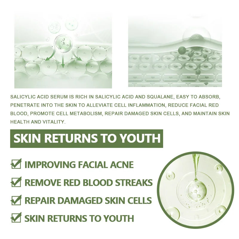 Anti-Acne Face Serum Salicylic Acid Acne Removing Essence Squalane Vitamin E Moisturizing Brightening Korean Skincare Products