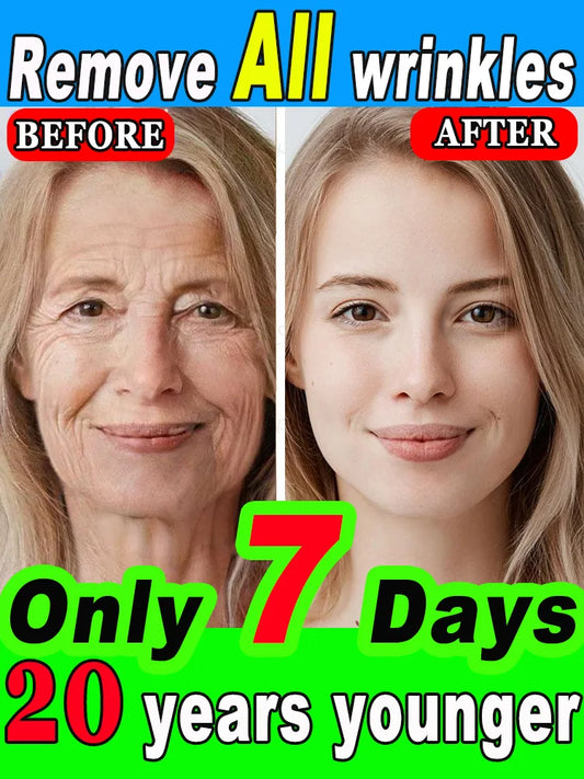 Wrinkles disappear