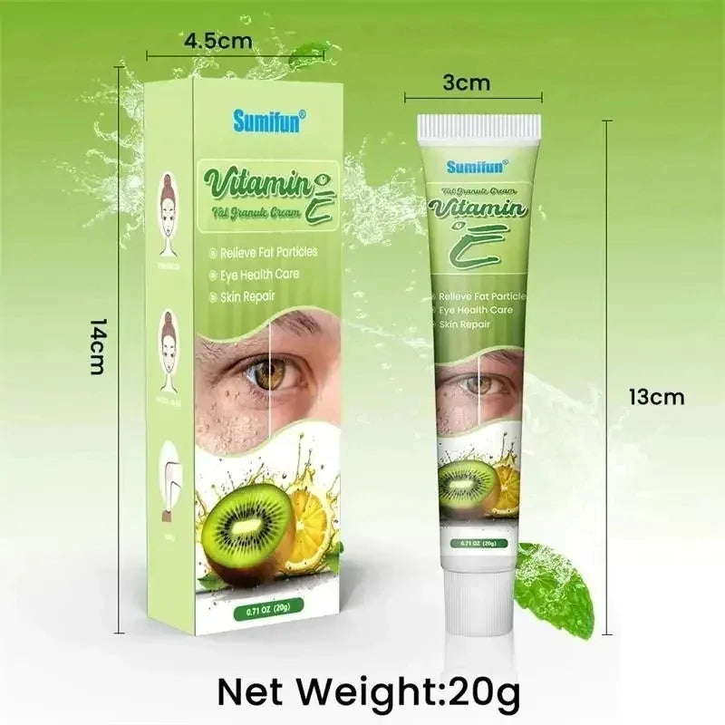 Fat Granules Remover Eye Cream Effective Remove Fat Granules Puffiness Anti-Particles Milia Remover Product Repair Eye Skin Care