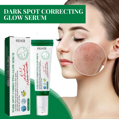 Nicotinamide Whitening Freckles Face Cream Remove Melasma Dark Spots Corrector Fade Melanin Acne Anti-Aging Brighten Skin Care