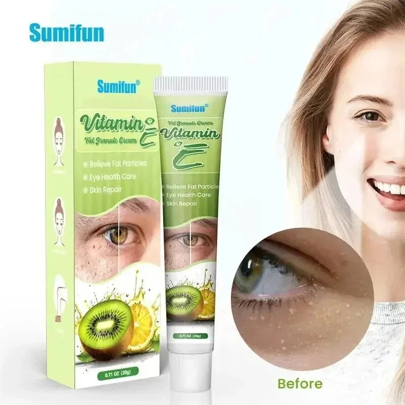 Fat Granules Remover Eye Cream Effective Remove Fat Granules Puffiness Anti-Particles Milia Remover Product Repair Eye Skin Care