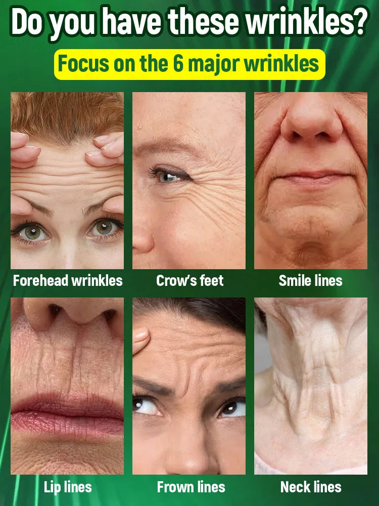 Wrinkles disappear in just 7 days