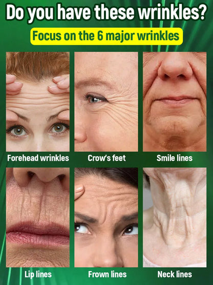 Wrinkles disappear in just 7 days