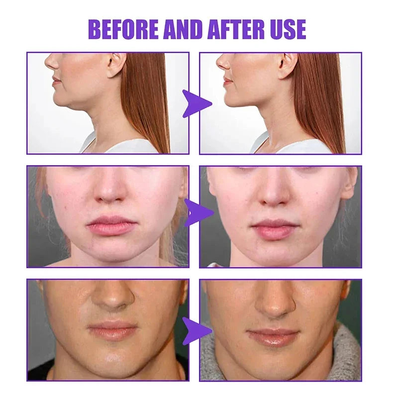 V Face Slimming Cream Enzyme Massage Cream Firm Face Lift To Remove Masseter Double Chin To Lighten Neck Line Fat Burning Cream