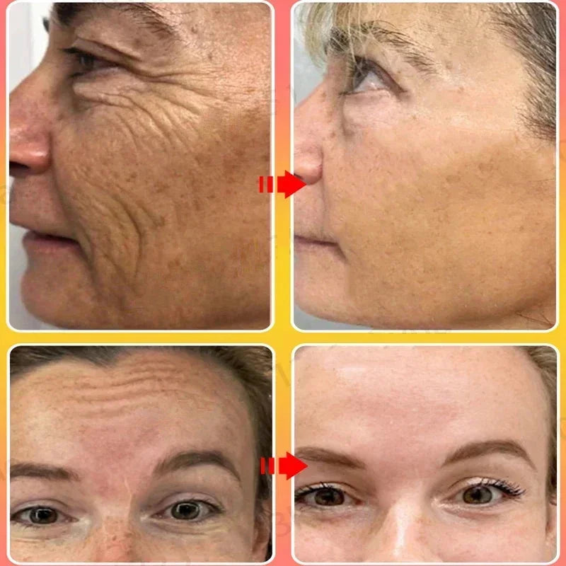 Sakura Whitening Face Serum Anti Aging Fade Fine Lines Tighten Pores Improve Melanin Pigment Dull Moisturizer Brighten Skin Care