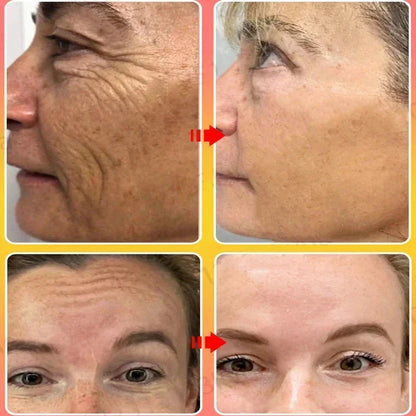 Sakura Whitening Face Serum Anti Aging Fade Fine Lines Tighten Pores Improve Melanin Pigment Dull Moisturizer Brighten Skin Care