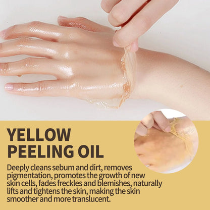 Strong Yellow Peeling Oil Bleach Dark Skin Whiten Lotion Lighten Body Elbow Knee Hand Exfoliate Dead Skin Nourish Even Skin Tone